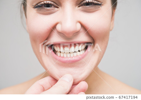 checking the teeth 67417194