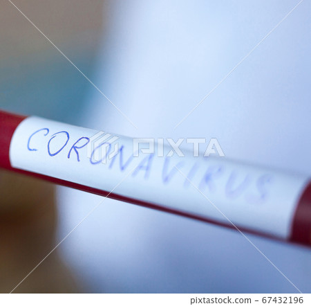 Blood test tube. Testing for Coronavirus disease. Blood test tube. Testing for Coronavirus disease. 67432196