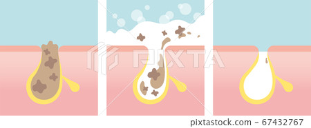 Skin cross section, pore cleansing. Clean pores with soap or face wash. Skin cross section, pore cleansing. Clean pores with soap or face wash. 67432767