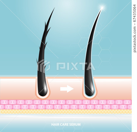Hair care serum follicle diagnostics. Anatomy skin, medical human, epidermis layer, vector illustration design. Hair care serum follicle diagnostics. Anatomy skin, medical human, epidermis layer, vector illustration design. 67435064
