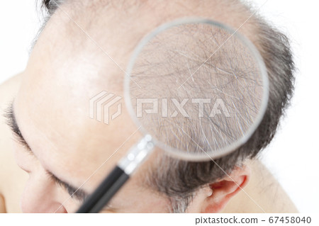 A thin hair man 67458040