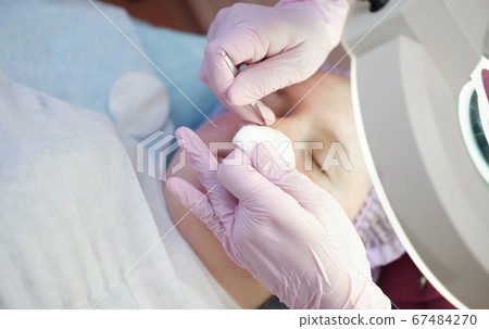 Procedure mechanical face cleaning in beauty salon.  67484270