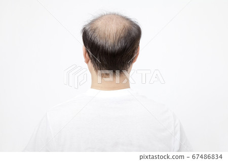 瘦頭髮男人的背影 67486834