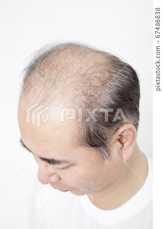 A thin hair man 67486838