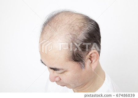 一個瘦頭髮的男人 一個瘦頭髮的男人 67486839