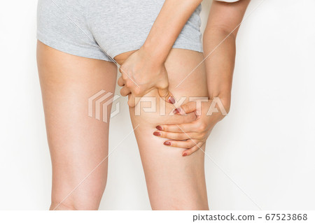 Thigh cellulite / young woman Thigh cellulite / young woman 67523868