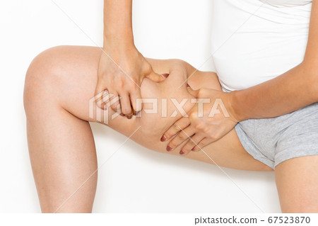 Thigh cellulite / young woman 67523870
