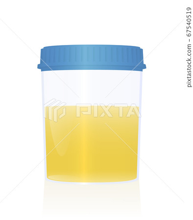 Urine sample in a specimen cup with blue cap for urological analysis and medical examination. Isolated vector illustration on white background. 67540519