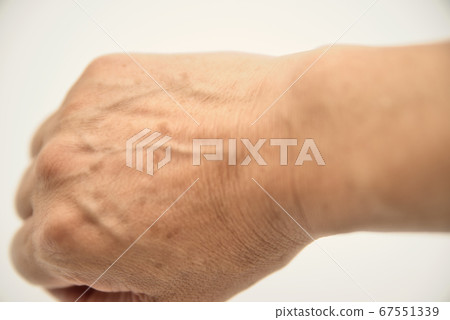 老右手背5 老右手背5 67551339