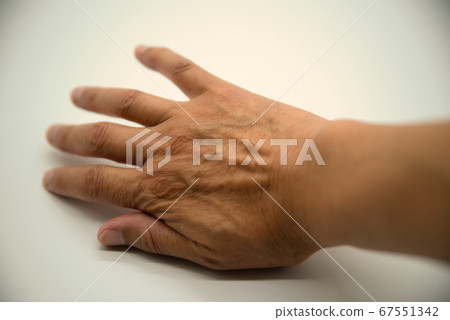 Right hand back 2 with old man's stains 67551342