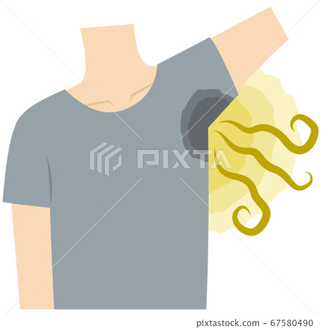 Men who suffer from armpit sweat, armpit odor, body odor Men who suffer from armpit sweat, armpit odor, body odor 67580490