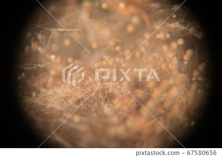 Backgrounds Colony Characteristics of Rhizopus (bread mold) is a genus of common saprophytic fungi, Rhizopus (bread mold) under the microscope. 67580656