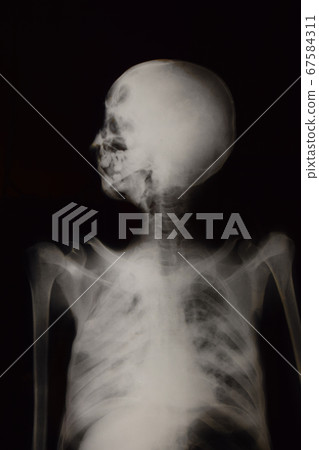 Human upper body roentgenogram Human upper body roentgenogram 67584311