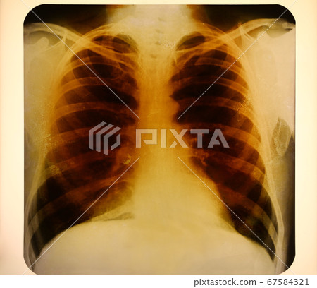 Vintage roentgenogram or photofluorogram Vintage roentgenogram or photofluorogram 67584321
