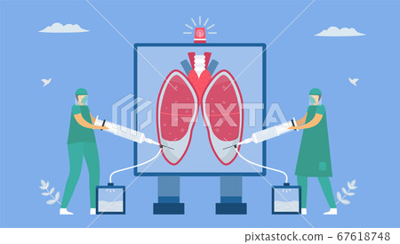 Pleural effusion is collection of excess fluid Pleural effusion is collection of excess fluid 67618748