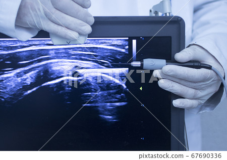 EPI dry needling ultrasound scan 67690336