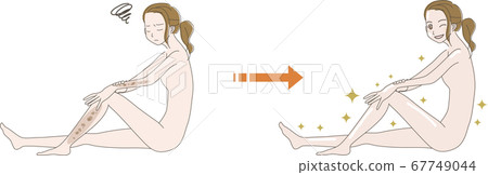 Illustration of a woman who is worried about stains Before After 67749044