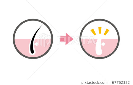 Image illustration of hair loss (hair root, waste hair) 67762322