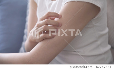 Young woman scratching her arm 67767484