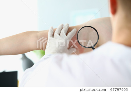Doctor examines through magnifying glass allergic reaction on man hand. 67797903