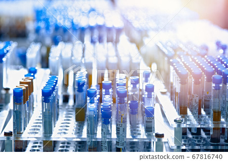 Test tubes with biomaterial in the laboratory 67816740
