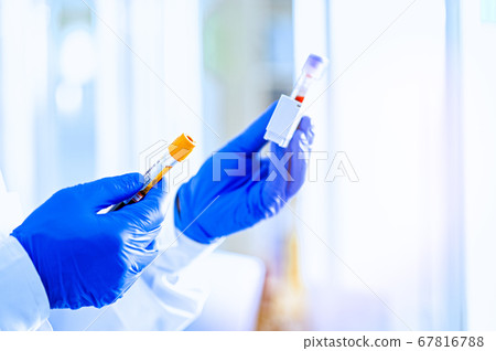 Hands in rubber gloves hold test tubes. Hands in rubber gloves hold test tubes. 67816788