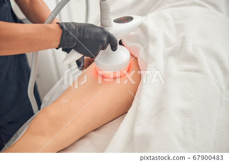 Woman getting relifting treatment on her legs Woman getting relifting treatment on her legs 67900483
