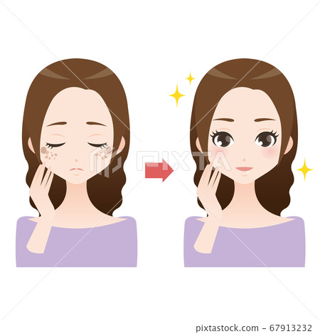 Comparative illustration of a woman suffering from spots and dull skin 67913232