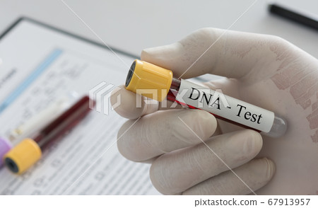dna testing 67913957