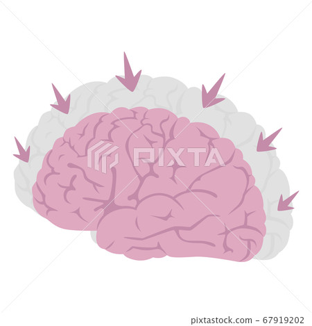 由於疾病收縮的大腦的插圖。 由於疾病收縮的大腦的插圖。 67919202