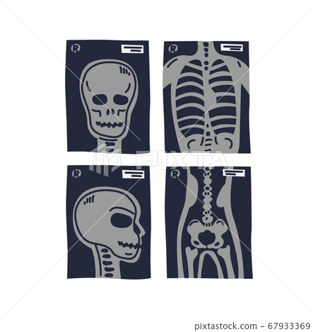 X-ray shots. Stylized x-ray pictures of human X-ray shots. Stylized x-ray pictures of human 67933369