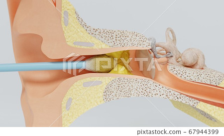 3d render ear cleansing earwax ear stick. 3d illustration 67944399