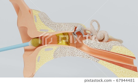 3d render ear cleansing earwax ear stick. 3d illustration 3d render ear cleansing earwax ear stick. 3d illustration 67944481