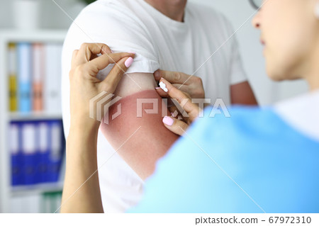 Nurse applies sunburn cream to patient closeup 67972310