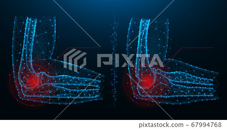 Elbow joint pain blue polygonal vector 67994768