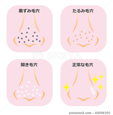Nose pore pattern 68006305
