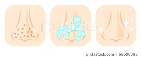 洗鼻孔的插圖 68006388