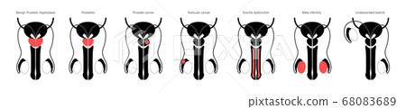Reproductive system concept 68083689