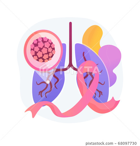 Lung cancer abstract concept vector illustration. 68097730