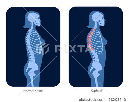 Spine X ray Spine X ray 68203340