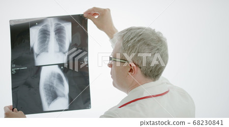 Doctor examines chest x-ray shot on a film viewer Doctor examines chest x-ray shot on a film viewer 68230841