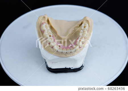 Teeth ceramics dentures on printed acrylic model in dental lab. Top view. 68263436
