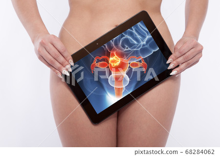 Screening of the reproductiv organs of a woman Screening of the reproductiv organs of a woman 68284062