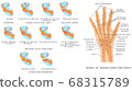 Wrist fracture (Scaphoid) 68315789