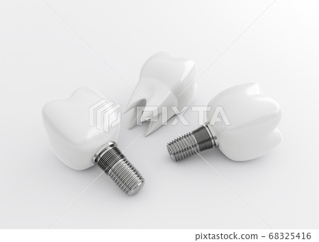 Tooth Crown and Tooth Implants on white background, artificial tooth, 3d render 68325416