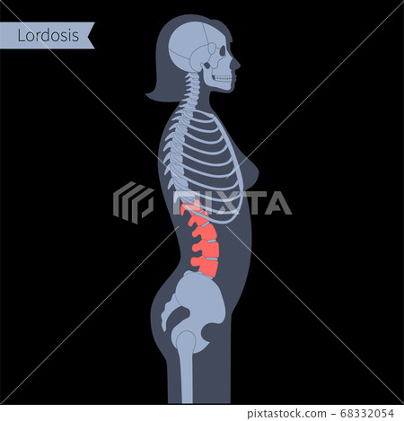 Spine X ray Spine X ray 68332054