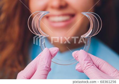 Close-up portrait of a female patient visiting dentist for teeth whitening in clinic,Teeth whitening procedure. Close-up portrait of a female patient visiting dentist for teeth whitening in clinic,Teeth whitening procedure. 68361256