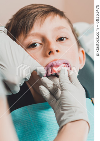 Registration of impressions and bites in a young teenager. Functional modern dental diagnostics. 68361479