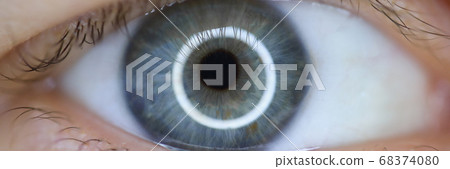 Laser correction vision concept 68374080