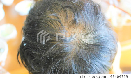 Male crown Male crown 68404769
